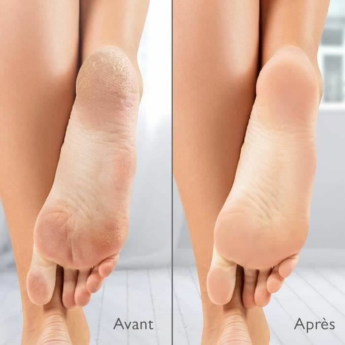 Electric Callus Remover Silk´n Vacupedi (5 Μονάδες) Electric Callus Remover Silk´n Vacupedi (5 Μονάδες)